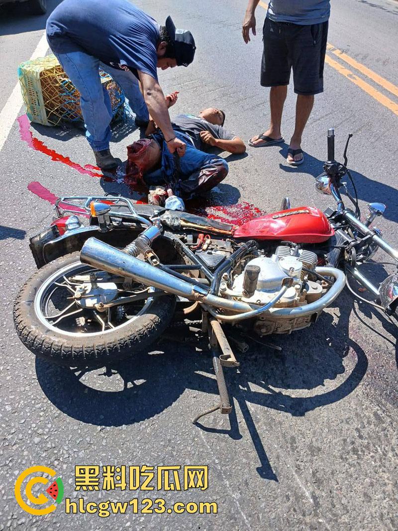 血腥恐怖交通事故，圣克鲁斯男骑手出车祸，左腿被当场撞断，现场视频流出胆小者勿入！  第1张