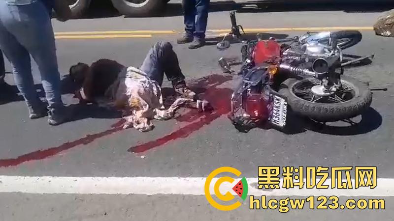 血腥恐怖交通事故，圣克鲁斯男骑手出车祸，左腿被当场撞断，现场视频流出胆小者勿入！  第2张