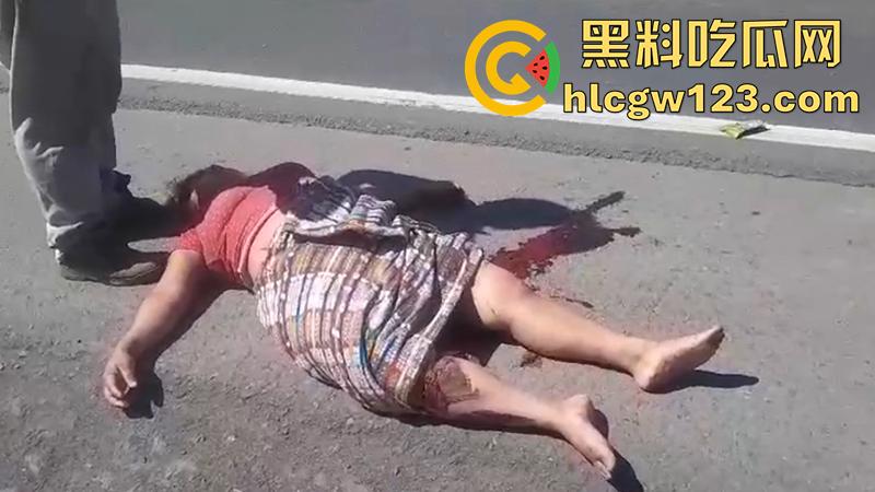 血腥恐怖交通事故，圣克鲁斯男骑手出车祸，左腿被当场撞断，现场视频流出胆小者勿入！  第3张