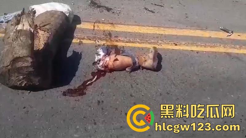 血腥恐怖交通事故，圣克鲁斯男骑手出车祸，左腿被当场撞断，现场视频流出胆小者勿入！  第4张