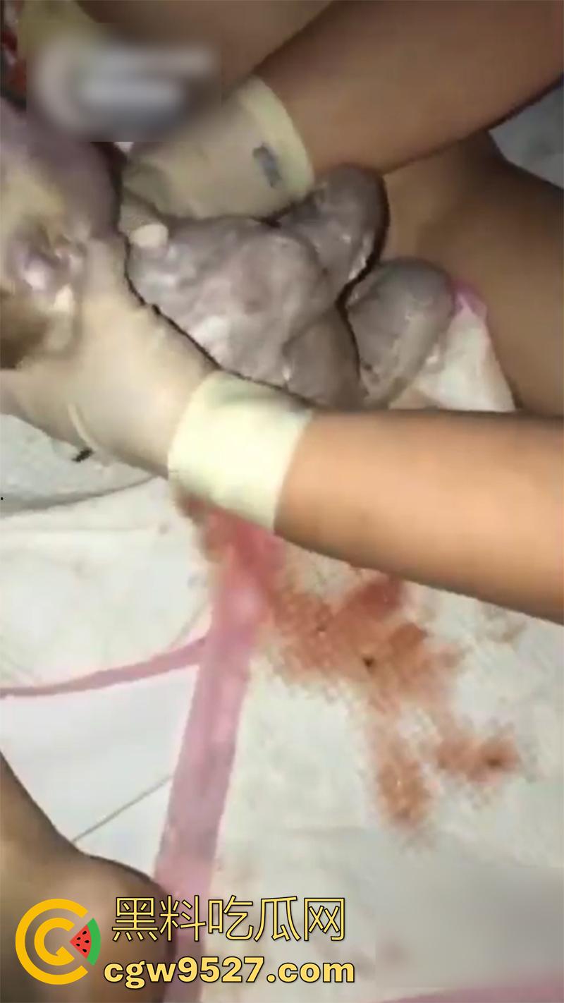 孕妇接生现场画面，体验生孩子的全过程，幸亏是个大肥逼，不然一定痛死了，原来大家都是这么来的啊！  第9张