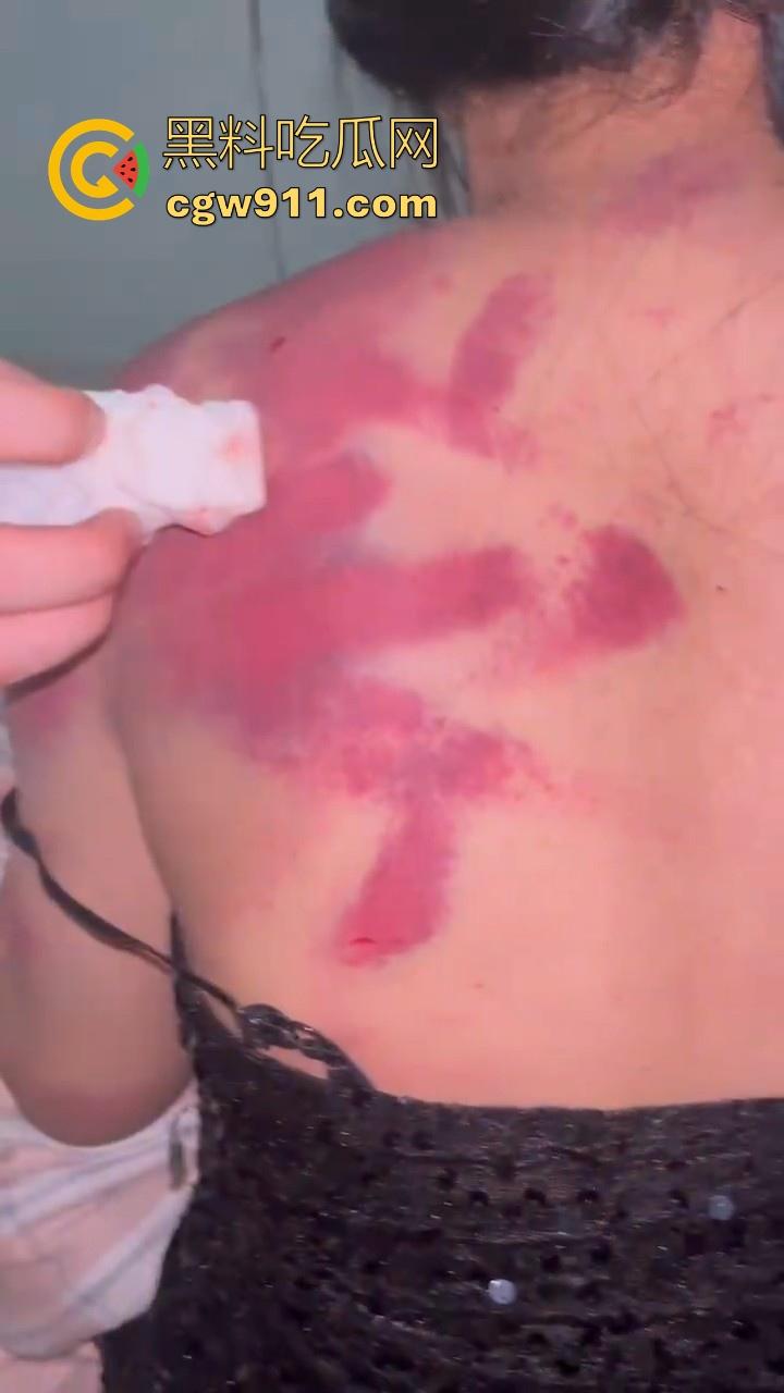 广西精神出租房围殴霸凌敌对小太妹，棍棒齐上，拳打脚踢，脱下衣服伤痕累累，战斗力丝毫不输男的！  第8张