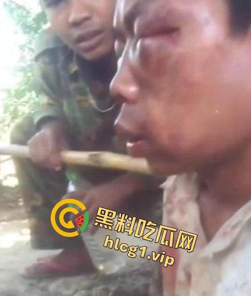 缅甸妙瓦底军阀虐待人质视频曝光，男子被殴打至面目全非，血迹斑斑的恐怖真相！  第3张
