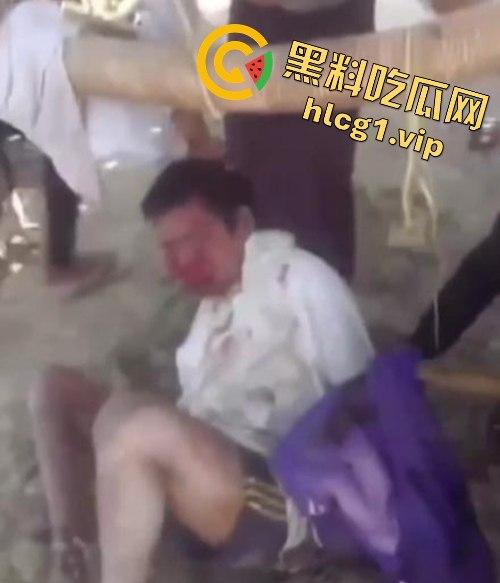 缅甸妙瓦底军阀虐待人质视频曝光，男子被殴打至面目全非，血迹斑斑的恐怖真相！  第4张