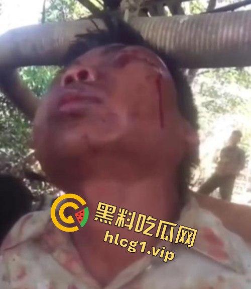 缅甸妙瓦底军阀虐待人质视频曝光，男子被殴打至面目全非，血迹斑斑的恐怖真相！  第6张