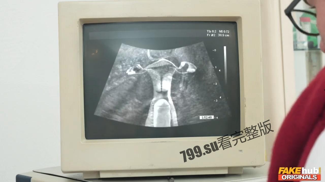 奥斯卡牛头人奖”获奖短片 老公陪老婆看医生 老婆被医生操了 监视器还能看到鸡鸡抽插  第3张