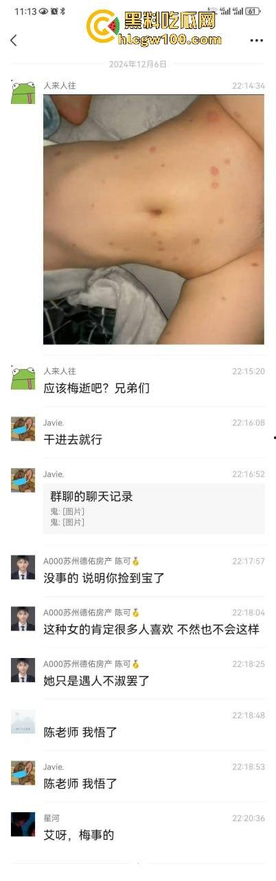 河南信阳啤酒森林酒吧惊现病毒母体！毒王身体浑身溃烂吓退众人，最近国内真的特别多各位瓜友一定要注意。  第10张