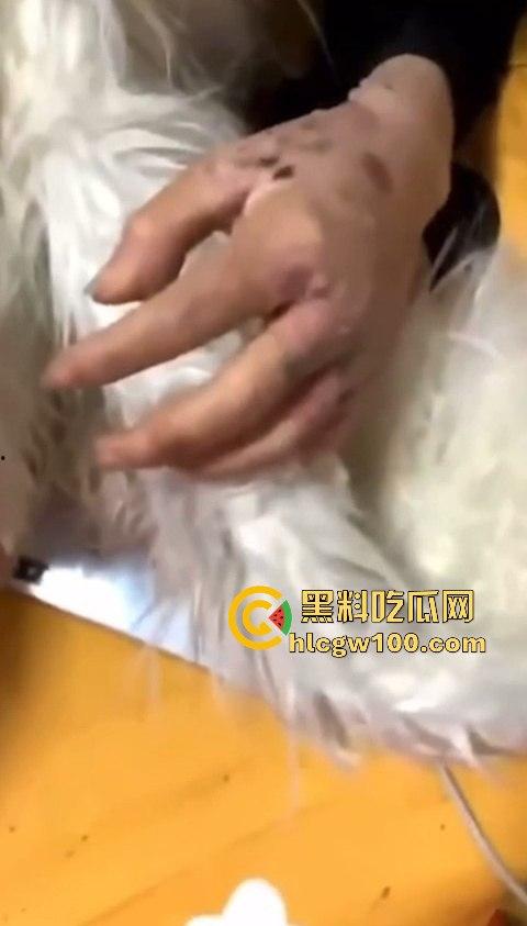 河南信阳啤酒森林酒吧惊现病毒母体！毒王身体浑身溃烂吓退众人，最近国内真的特别多各位瓜友一定要注意。  第18张