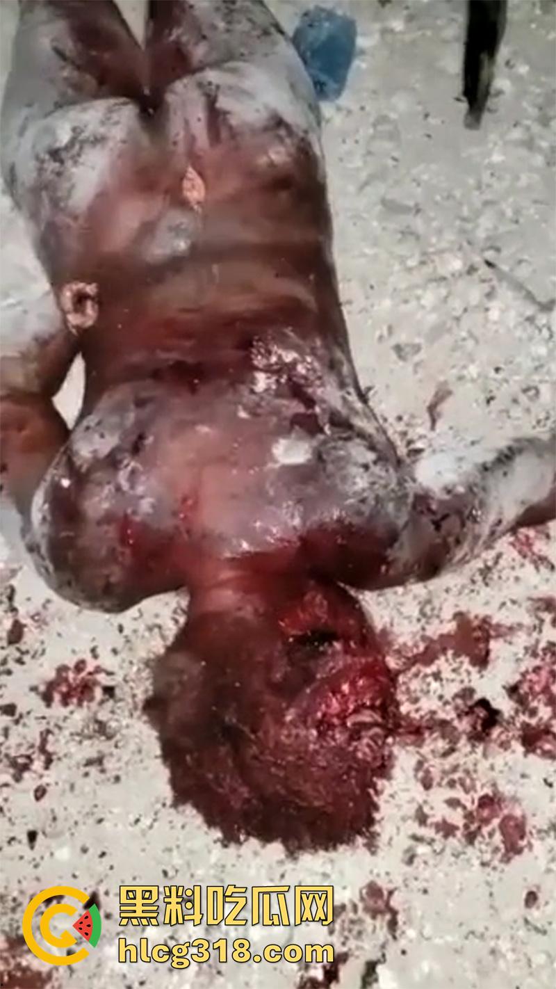 非洲大奶黑妹被砍断双手，棍棒砸扁头杀害后，被一群男子当场分尸割肉，还有人拿棍捅逼，真变态啊！  第1张