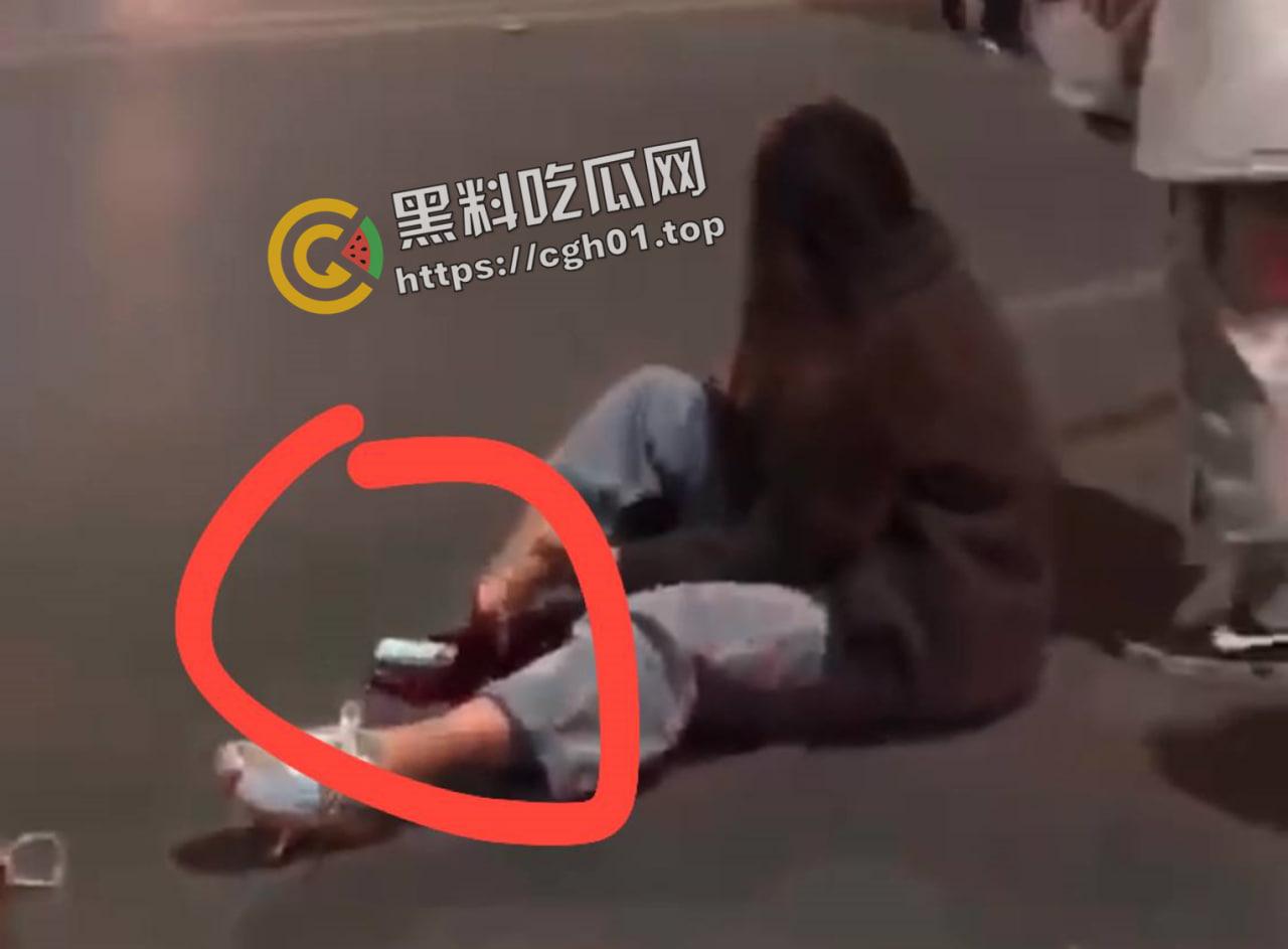 摩托车女骑士装上大货车 小腿直接断掉 现场血腥画面流出  第2张