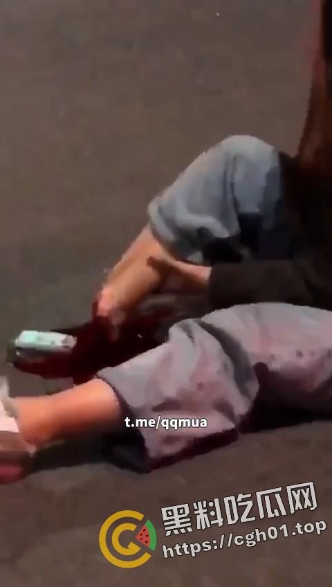 摩托车女骑士装上大货车 小腿直接断掉 现场血腥画面流出  第3张