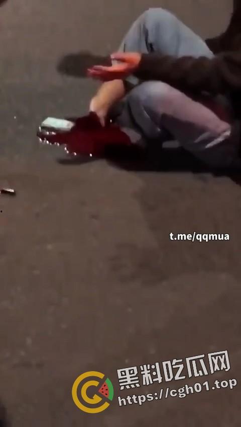 摩托车女骑士装上大货车 小腿直接断掉 现场血腥画面流出  第5张