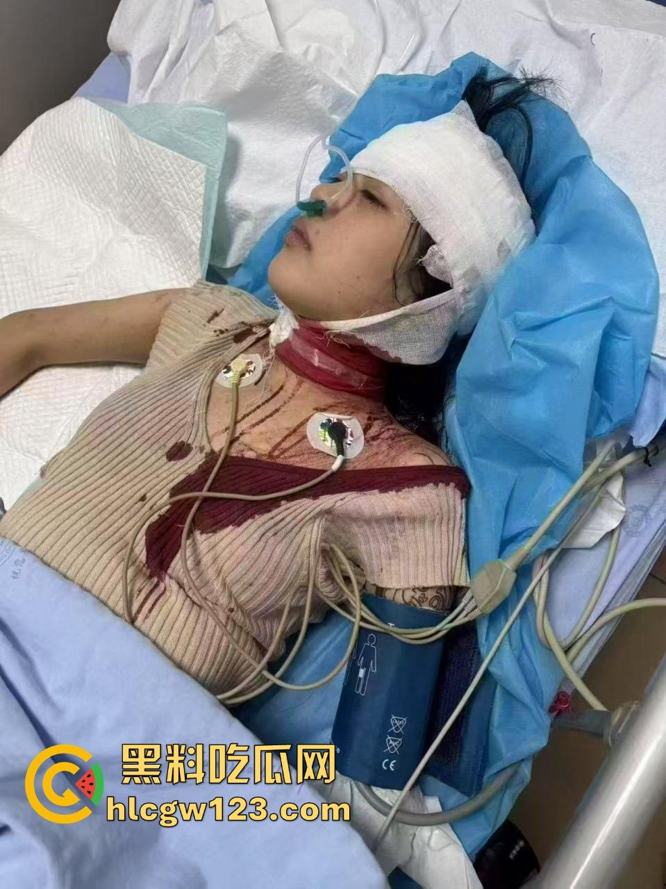 重庆精神小妹街头上演手起刀落,直接拿美工刀往脖子招呼,疯得不是一般狠! 第9张 重庆精神小妹街头上演手起刀落,直接拿美工刀往脖子招呼,疯得不是一般狠! 第9张