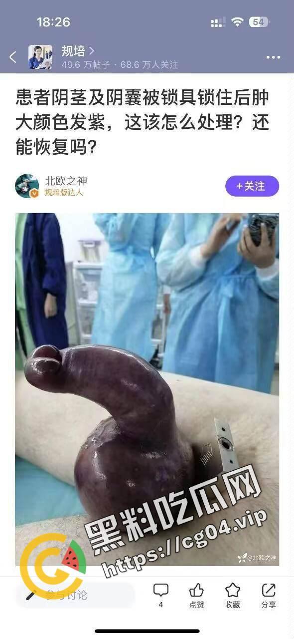 玩的花不是叫你玩命!w外国男子阳具被锁肿成大蒜一样 医生都束手无策  第1张