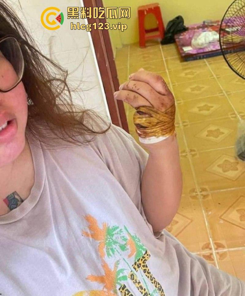 柬埔寨骗招诱国人入境 再要求家里500万赎人 剁手殴打暴力索钱视频流出 胆小慎入 第1张 柬埔寨骗招诱国人入境 再要求家里500万赎人 剁手殴打暴力索钱视频流出 胆小慎入 第1张