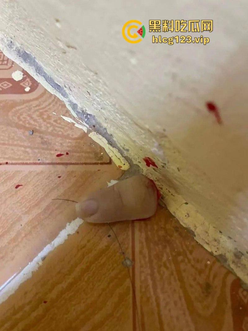 柬埔寨骗招诱国人入境 再要求家里500万赎人 剁手殴打暴力索钱视频流出 胆小慎入 第9张 柬埔寨骗招诱国人入境 再要求家里500万赎人 剁手殴打暴力索钱视频流出 胆小慎入 第9张