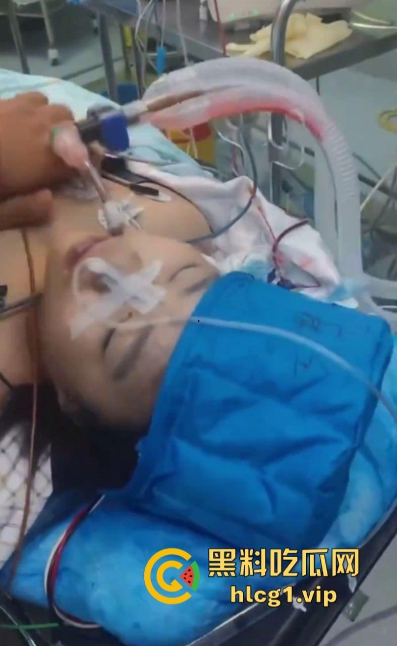 活阎王!哈尔滨市10岁小女孩微创手术身亡 器官被单独摘走! 第7张 活阎王!哈尔滨市10岁小女孩微创手术身亡 器官被单独摘走! 第7张