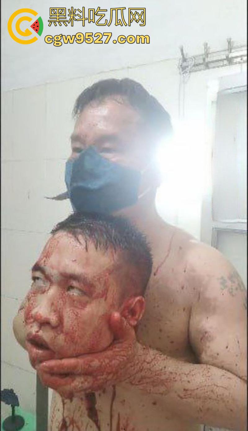 暗网越南屠夫案,男子自愿被杀,多角度砍头血如泉涌,干脆利落几秒剁头,现场原视频流出! 第2张 暗网越南屠夫案,男子自愿被杀,多角度砍头血如泉涌,干脆利落几秒剁头,现场原视频流出! 第2张