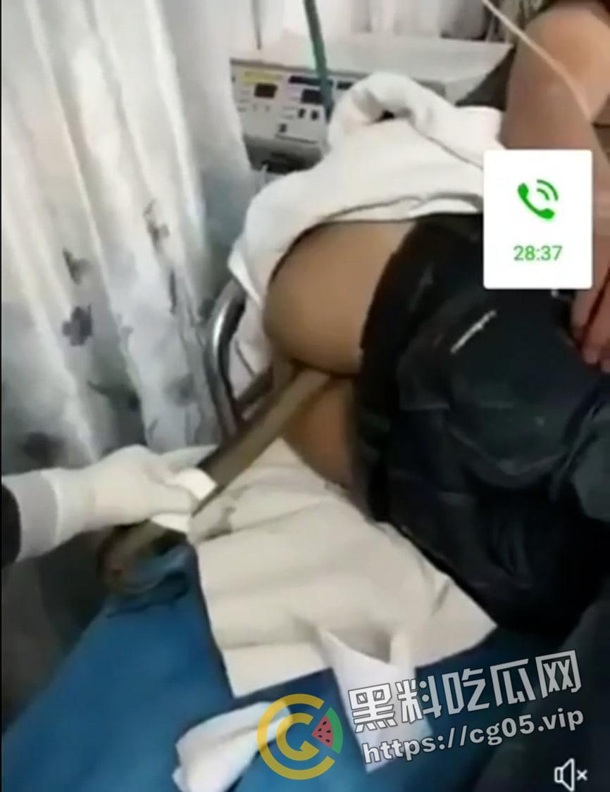 黄鳝入肛 一去不回 整活把自己整进医院了 医生扯出来半米长的黄鳝惊呆了  第1张
