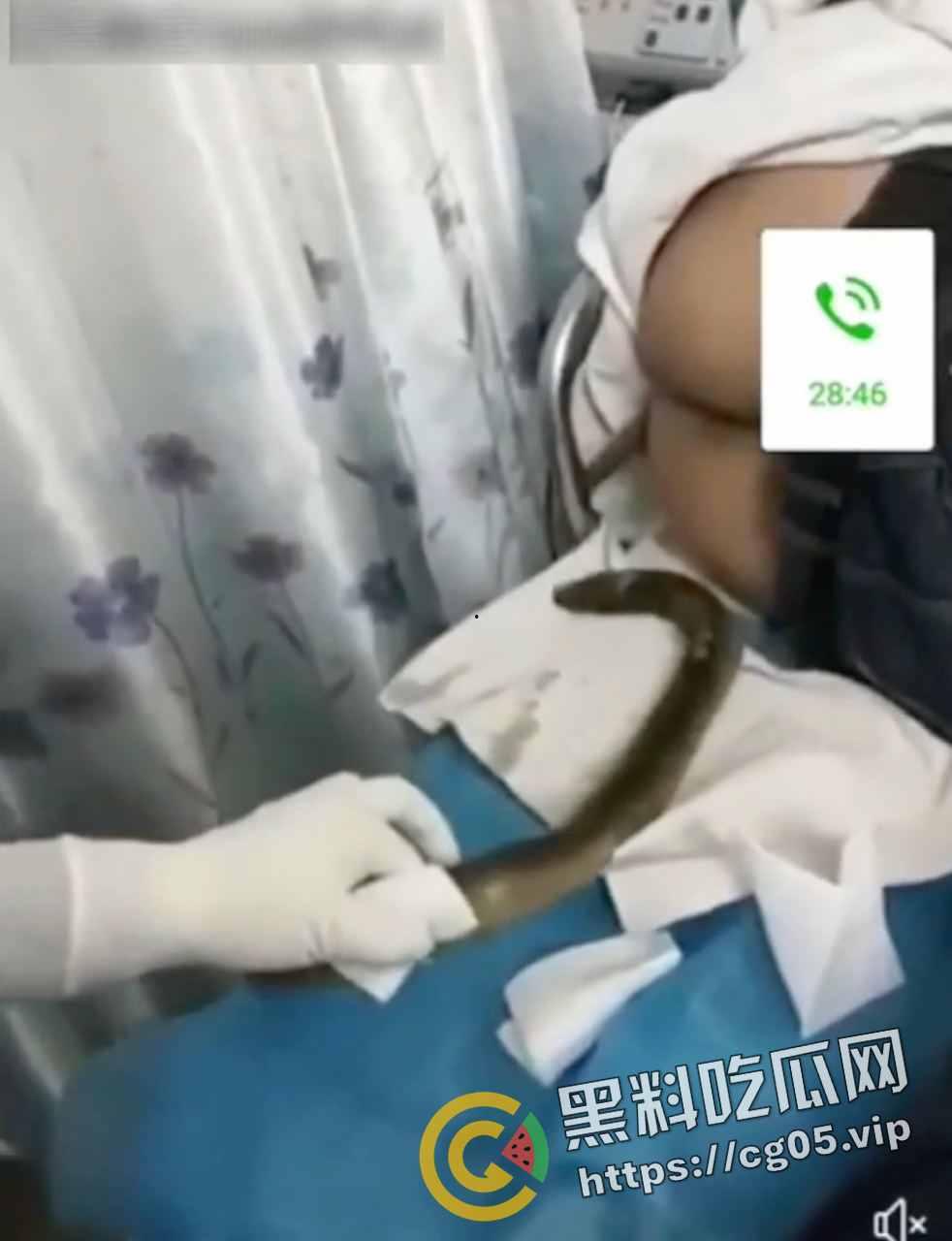 黄鳝入肛 一去不回 整活把自己整进医院了 医生扯出来半米长的黄鳝惊呆了  第4张