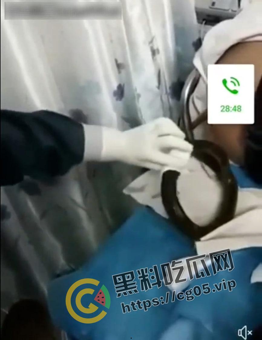 黄鳝入肛 一去不回 整活把自己整进医院了 医生扯出来半米长的黄鳝惊呆了  第5张