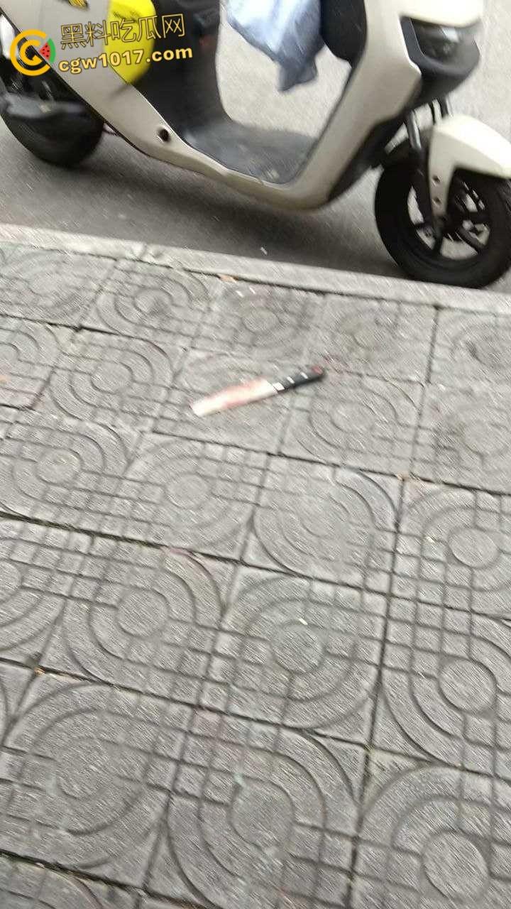 广西柳州金竺花苑小区门口，一男子持刀无差别砍人件，一名过路男子受伤送医，网传精神小伙疯狂行凶 !  第6张