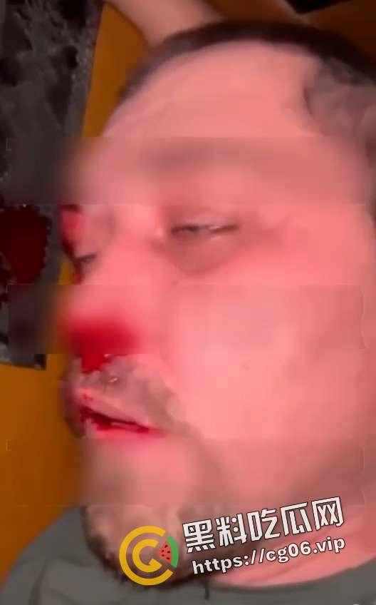 俄罗斯男子猥亵邻居女孩被监控拍下 第二天就被正义人士抓住打死  第4张