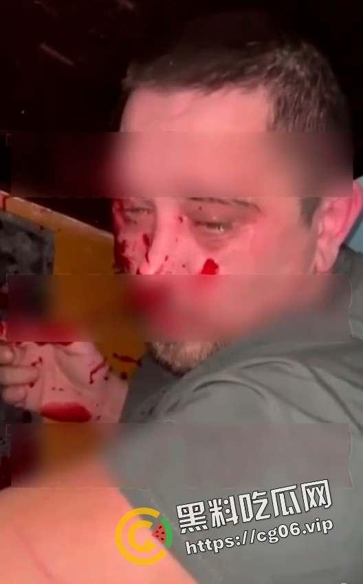 俄罗斯男子猥亵邻居女孩被监控拍下 第二天就被正义人士抓住打死  第6张