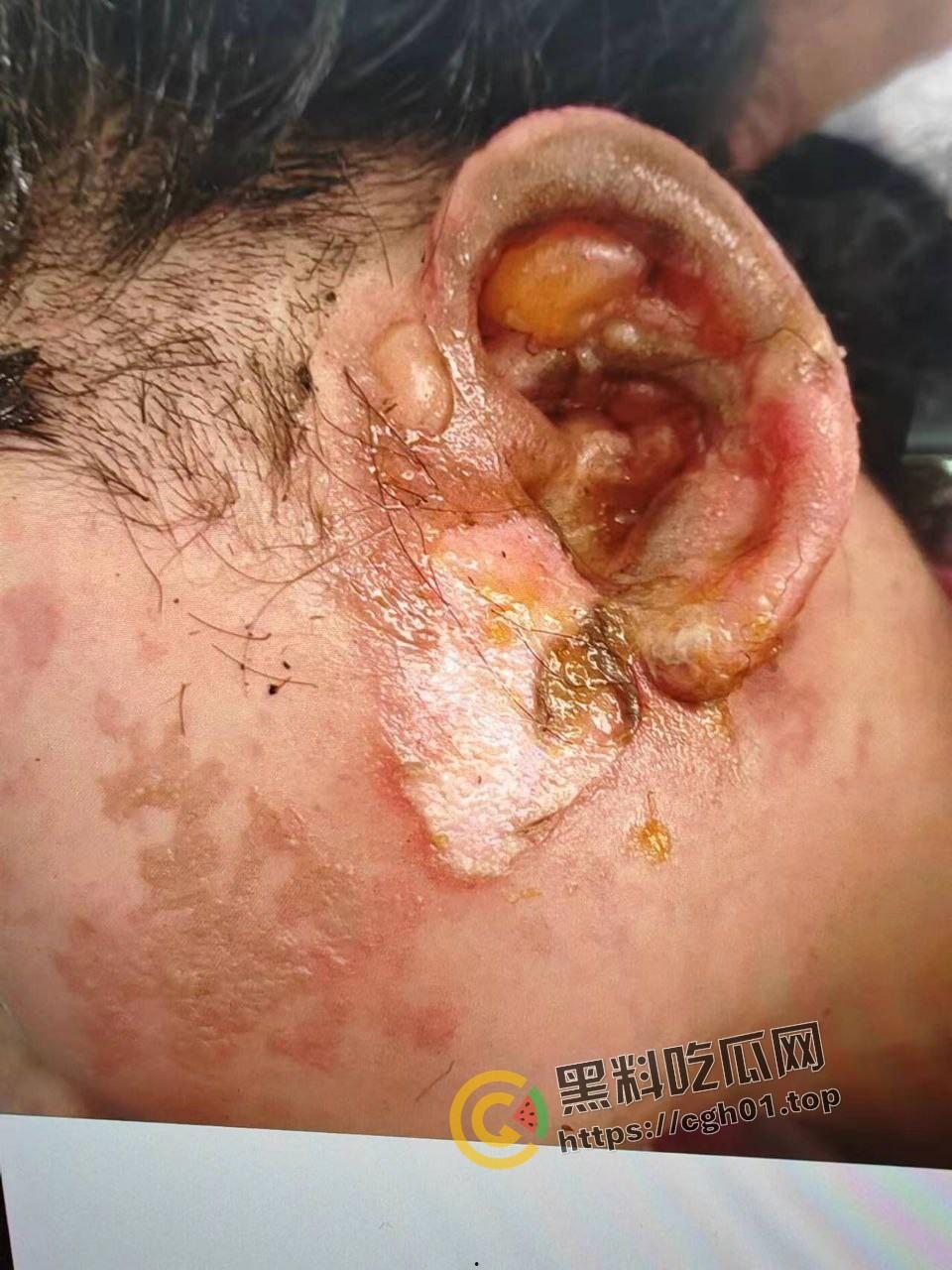 北京马坊镇放火杀人案 犯人【刘峰强】被抓 受害人全身烧烂 手臂被砍 全家老小失去人形 惨不忍睹 血腥慎点  第5张