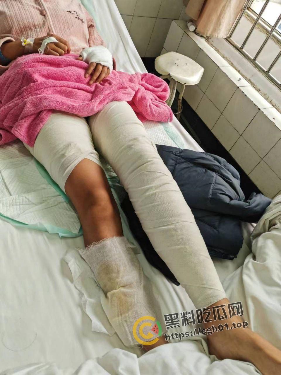 北京马坊镇放火杀人案 犯人【刘峰强】被抓 受害人全身烧烂 手臂被砍 全家老小失去人形 惨不忍睹 血腥慎点  第7张