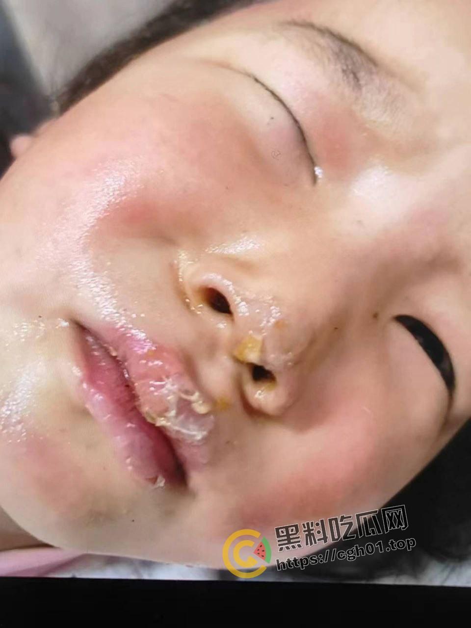 北京马坊镇放火杀人案 犯人【刘峰强】被抓 受害人全身烧烂 手臂被砍 全家老小失去人形 惨不忍睹 血腥慎点  第8张