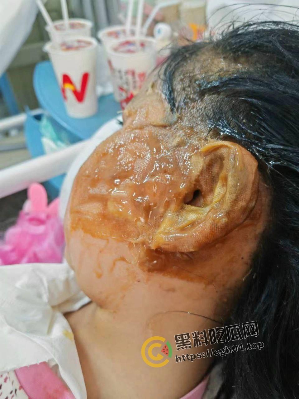 北京马坊镇放火杀人案 犯人【刘峰强】被抓 受害人全身烧烂 手臂被砍 全家老小失去人形 惨不忍睹 血腥慎点  第9张