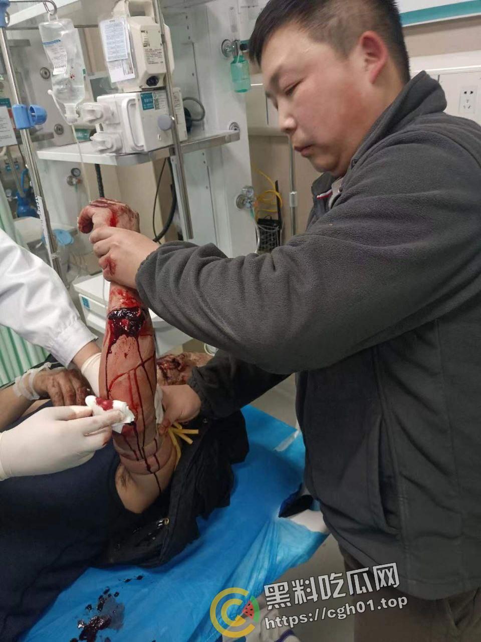 北京马坊镇放火杀人案 犯人【刘峰强】被抓 受害人全身烧烂 手臂被砍 全家老小失去人形 惨不忍睹 血腥慎点  第13张