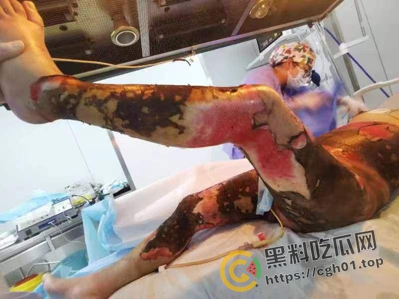 北京马坊镇放火杀人案 犯人【刘峰强】被抓 受害人全身烧烂 手臂被砍 全家老小失去人形 惨不忍睹 血腥慎点  第15张