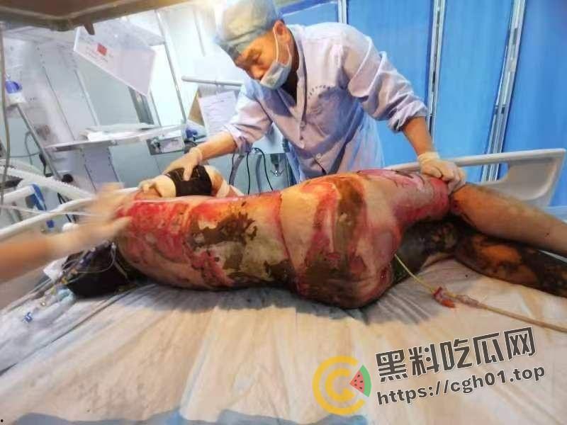 北京马坊镇放火杀人案 犯人【刘峰强】被抓 受害人全身烧烂 手臂被砍 全家老小失去人形 惨不忍睹 血腥慎点  第18张