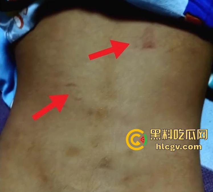 长沙幼儿园虐童！孩子被两名老师拖地打，家长怒发视频控诉！  第9张