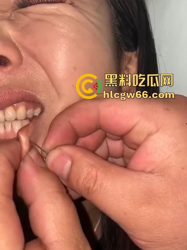 两女PK惩罚被主人把嘴缝在一起 过程居然毫无反抗 钢针刺进嘴巴看着都痛 不说还以为是缅北园区新惩罚呢  第7张