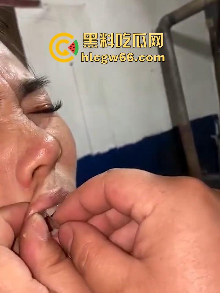 两女PK惩罚被主人把嘴缝在一起 过程居然毫无反抗 钢针刺进嘴巴看着都痛 不说还以为是缅北园区新惩罚呢  第9张