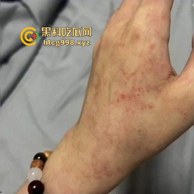 杭州惊现强吻狂魔！夜晚女生嘴唇被咬破，路人看了都以为是情侣打情骂俏，结果真是猥亵！  第12张