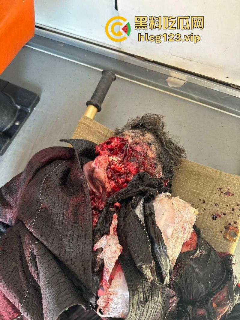 坐等看戏！伊朗对以色列的导弹袭击已结束 美准备好对抗伊朗？内含血腥无码画面 慎入！！！  第4张