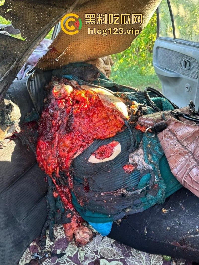 坐等看戏！伊朗对以色列的导弹袭击已结束 美准备好对抗伊朗？内含血腥无码画面 慎入！！！  第5张