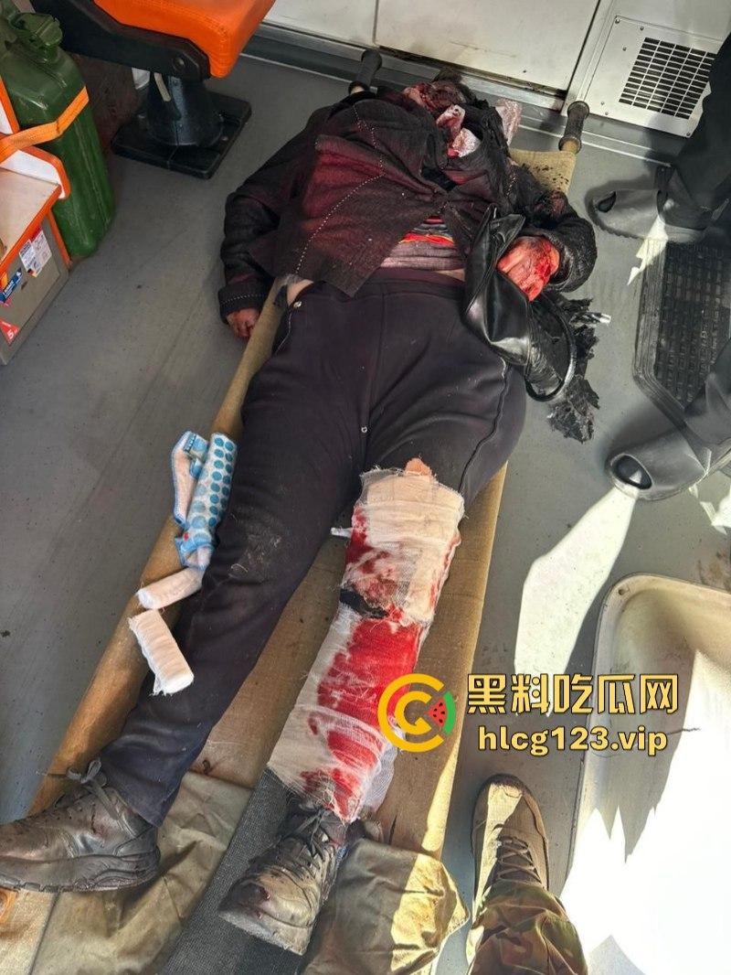 坐等看戏！伊朗对以色列的导弹袭击已结束 美准备好对抗伊朗？内含血腥无码画面 慎入！！！  第6张