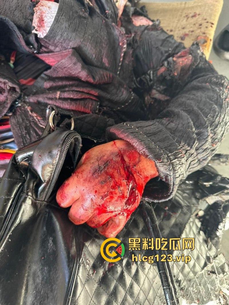 坐等看戏！伊朗对以色列的导弹袭击已结束 美准备好对抗伊朗？内含血腥无码画面 慎入！！！  第7张