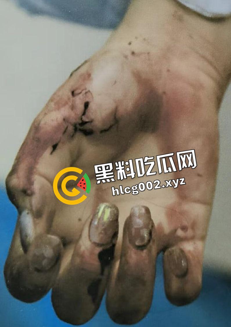 恐怖慎入！辽宁【徐园】案尸检现场视频流出 被前男友家暴致死打的面目全非  第7张