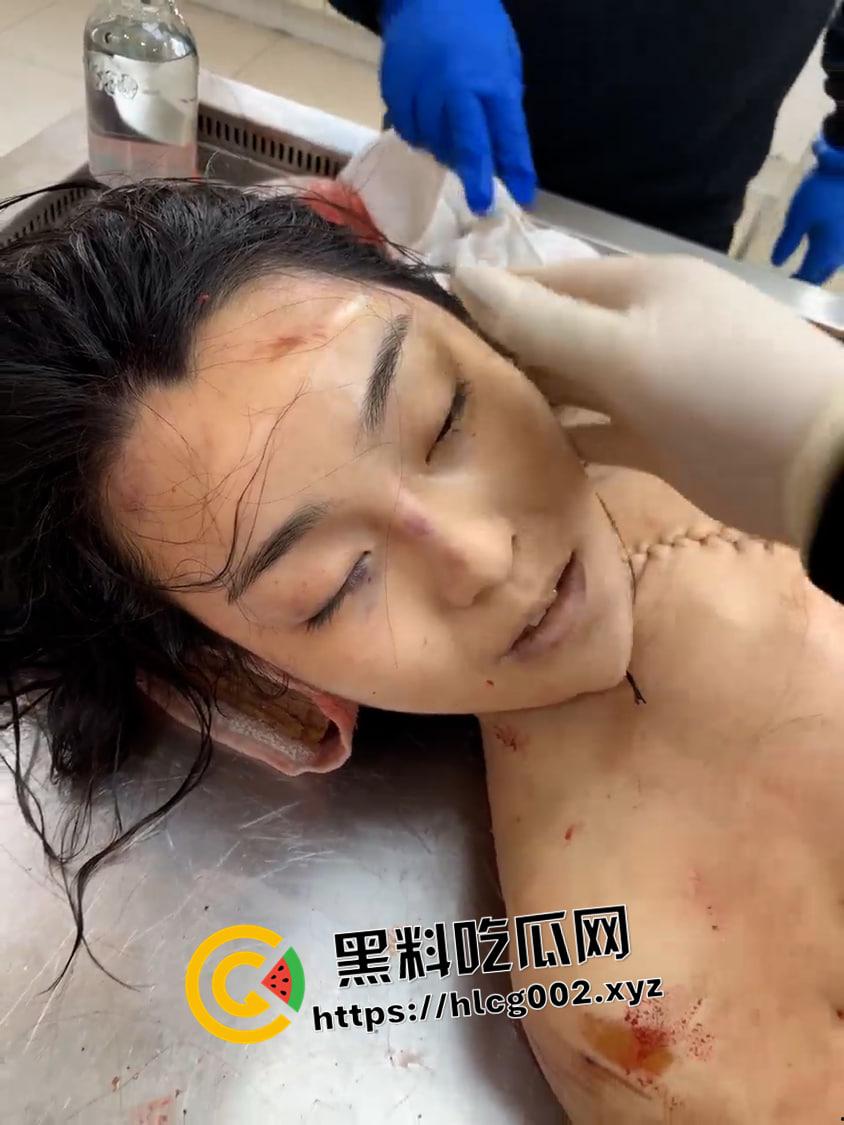 恐怖慎入！辽宁【徐园】案尸检现场视频流出 被前男友家暴致死打的面目全非  第9张