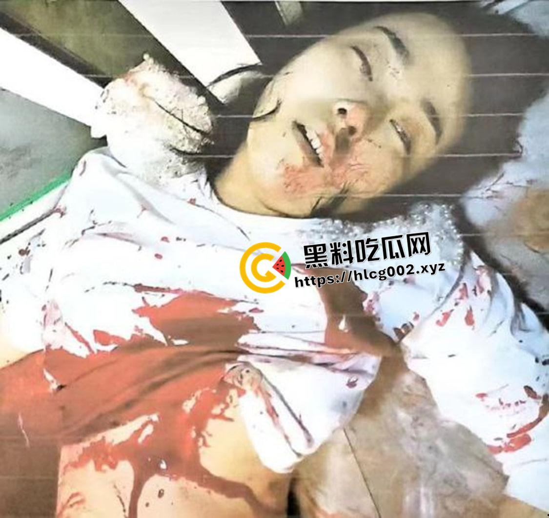 恐怖慎入！辽宁【徐园】案尸检现场视频流出 被前男友家暴致死打的面目全非  第10张