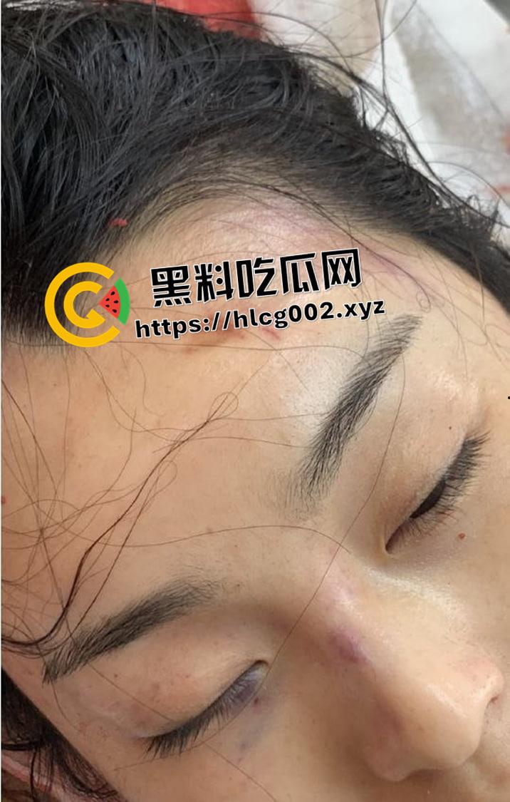 恐怖慎入！辽宁【徐园】案尸检现场视频流出 被前男友家暴致死打的面目全非  第11张