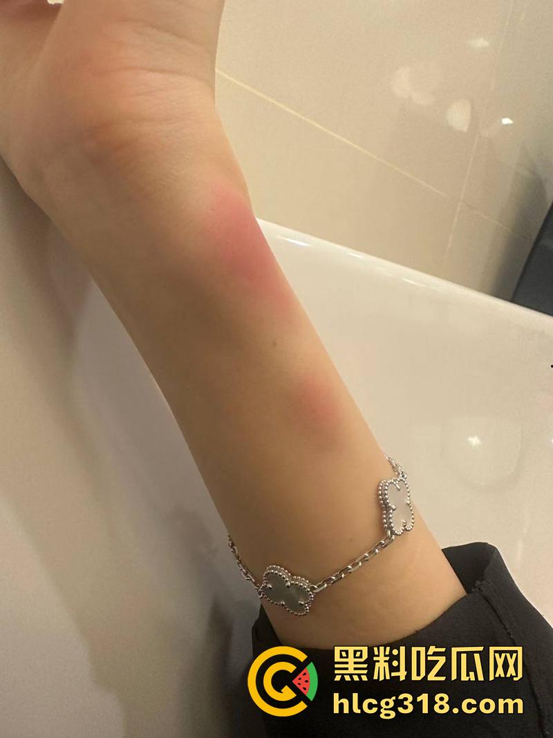 东南亚吸毒男模，无套和客人出台，双飞吸毒玩嗨杀死女友，还将女友闺蜜强奸砍头分尸，太变态了！  第5张