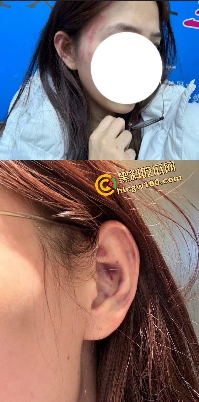 街球圈情侣大瓜！杭州街球手【程鑫凯】家暴女网红【鸡腿诺】多处打伤哭泣现场！独家开盒流出！  第13张