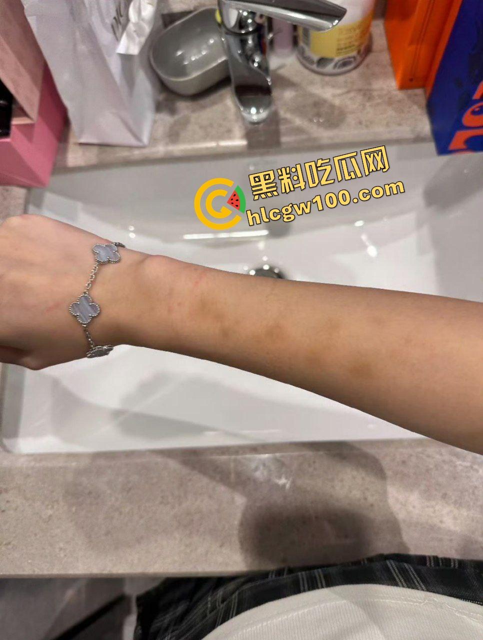 街球圈情侣大瓜！杭州街球手【程鑫凯】家暴女网红【鸡腿诺】多处打伤哭泣现场！独家开盒流出！  第14张